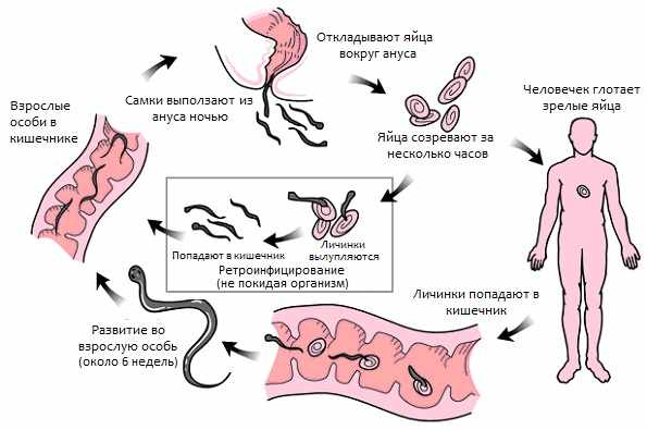 Как глисты попадают в попу