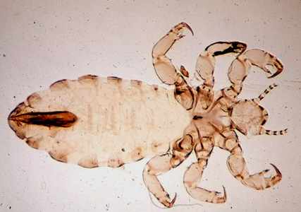 Pediculus Humanus Humanus