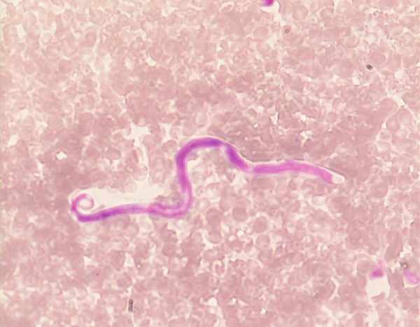 Микрофилярии у человека и животных