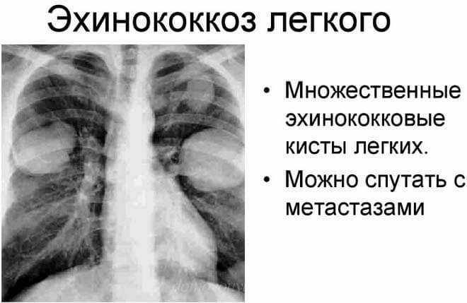 Что происходит в организме