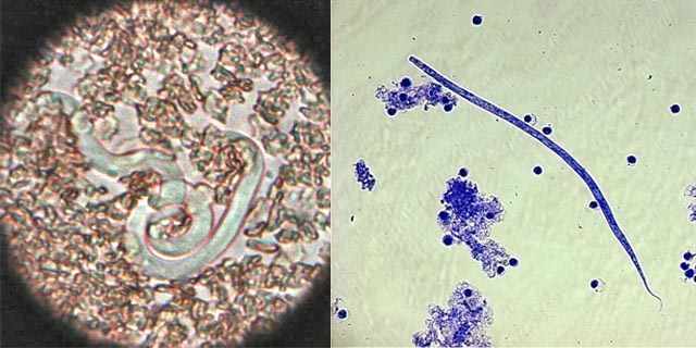 Dirofilaria immitis и Dirofilaria repens.