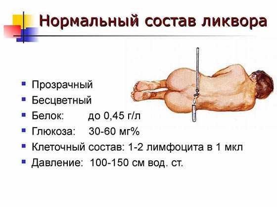 Анализ ликворной жидкости