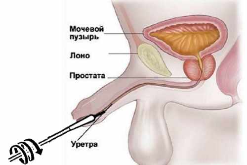 Забор мазка