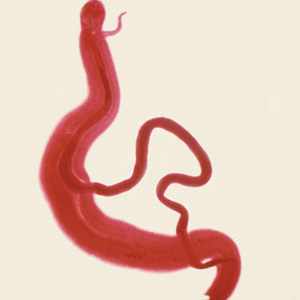 Schistosoma intercalatum