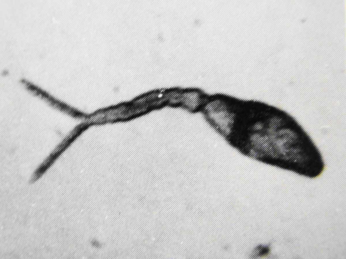 Schistosoma japonicum