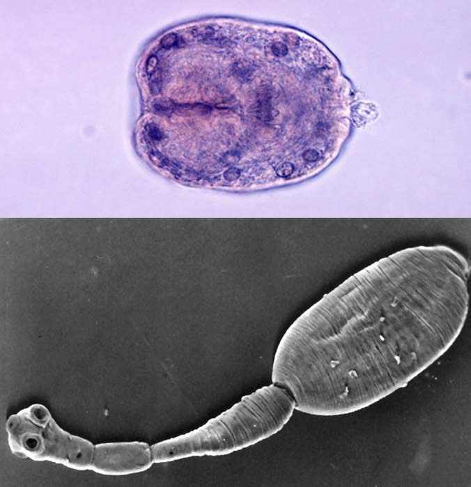 Echinococcus granulosus