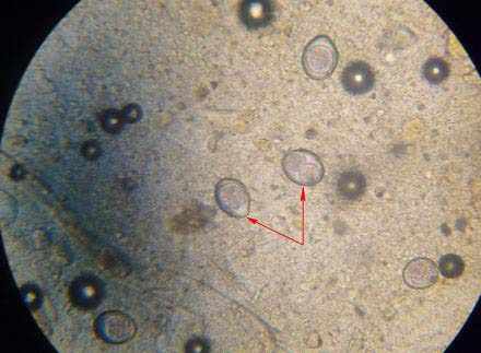Паразит под микроскопом