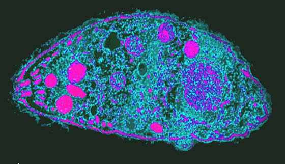 Toxoplasma