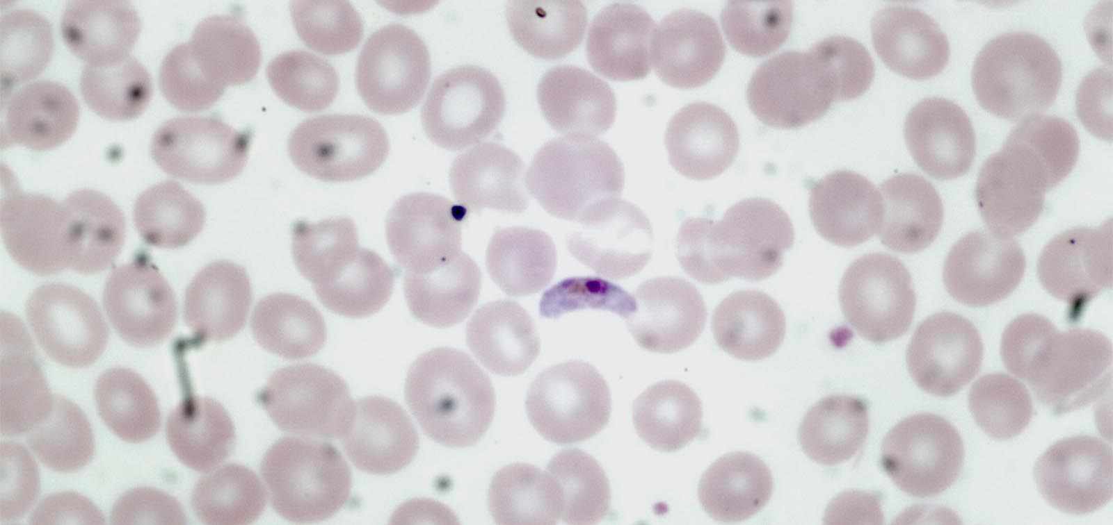 Plasmodium falciparum