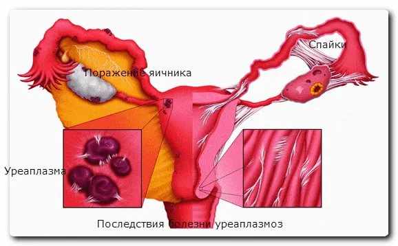 Возможные осложнения инфекции у мужчин