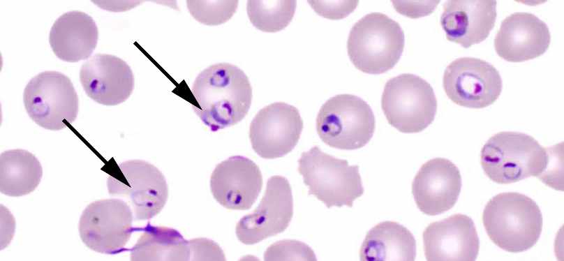 Строение Plasmodium Falciparum