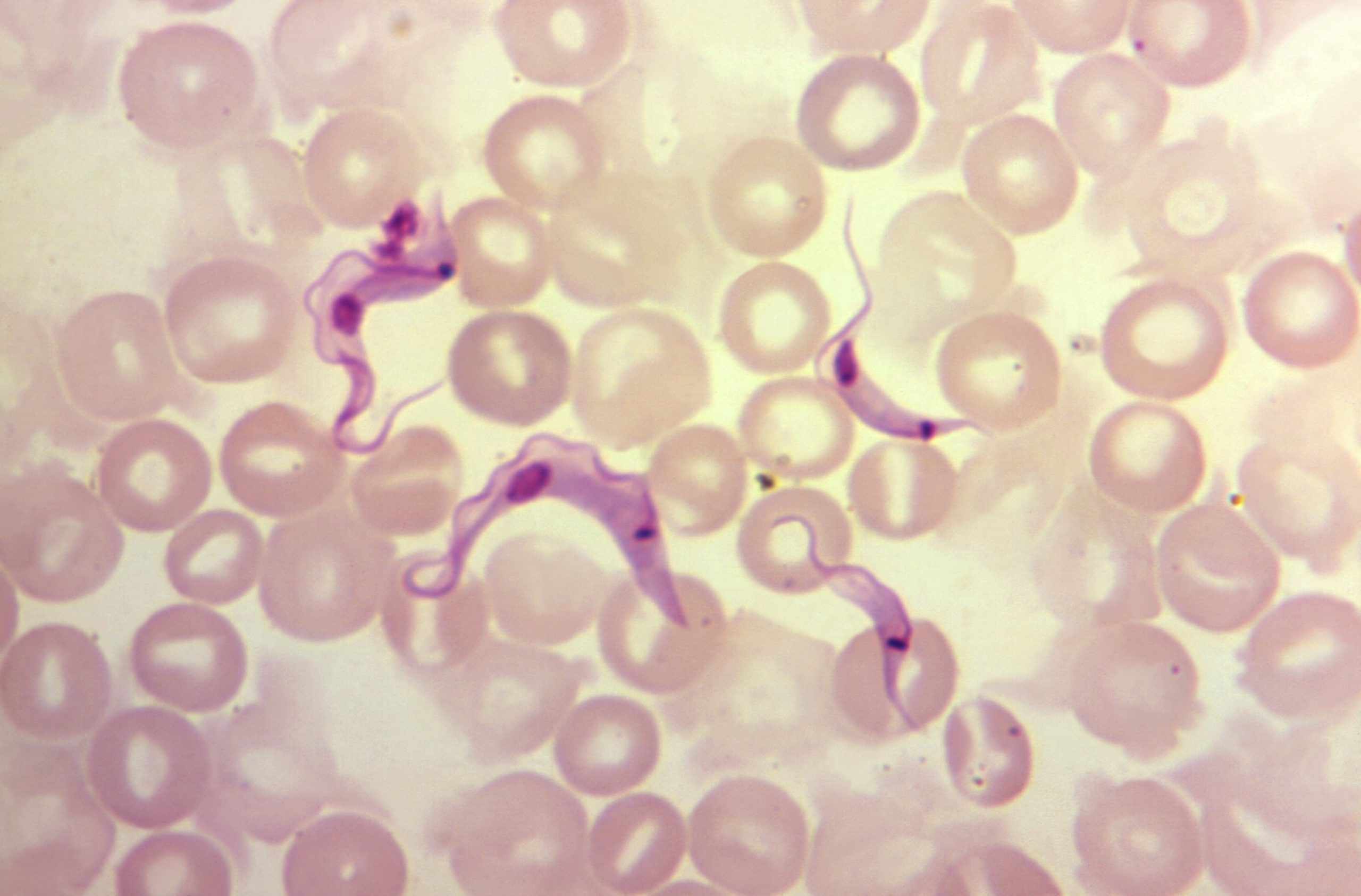 Trypanosoma cruzi