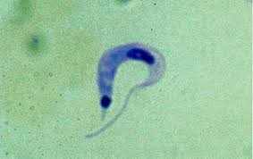 Trypanosoma cruzi