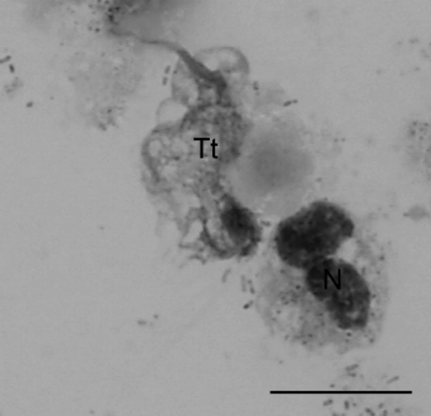 Trichomonas tenax