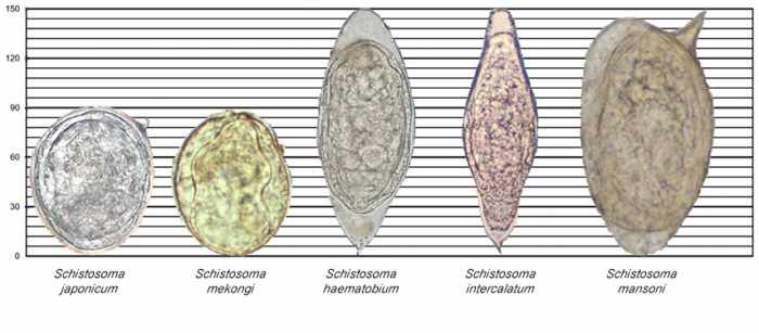 Что такое шистосомоз