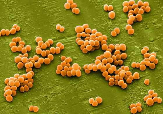 Staphylococcus aureus у ребенка