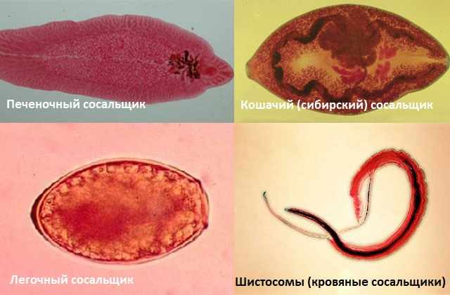 Черви-сосальщики (трематоды)