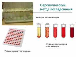 Серологические исследования