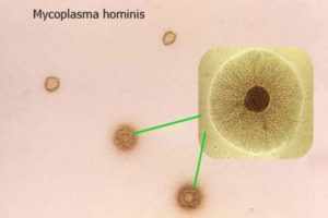 микоплазма хоминис