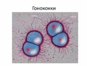 Инфекция Гонококковая