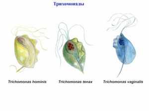 Что такое кишечная трихомонада