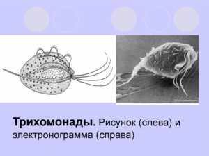 Что такое кишечная трихомонада 