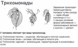 Хронический трихомониаз