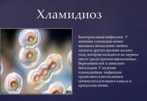 Сумамед при хламидиозе: насколько эффективен препарат в борьбе с хламидиями