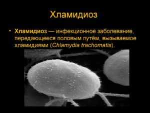 Сумамед при хламидиозе: насколько эффективен препарат в борьбе с хламидиями