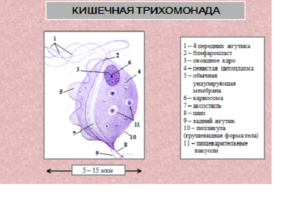 Что такое кишечная трихомонада 