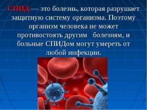 Как умирают от спида: развитие вич-инфекции, симптомы и причины смертности