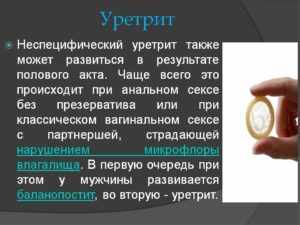 Уретрит