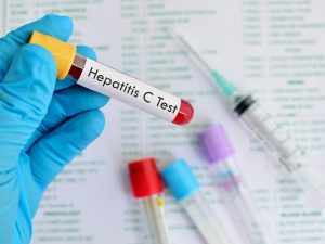 Hepatitis C