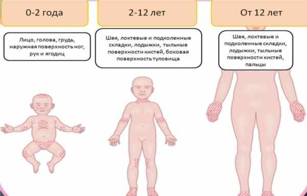 Изменение общего состояния по фазам