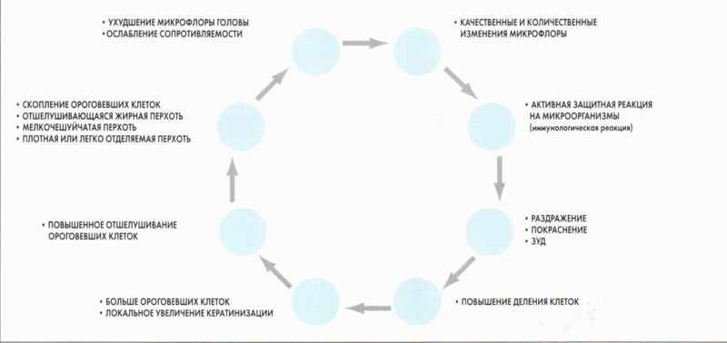 Механизм развития перхоти