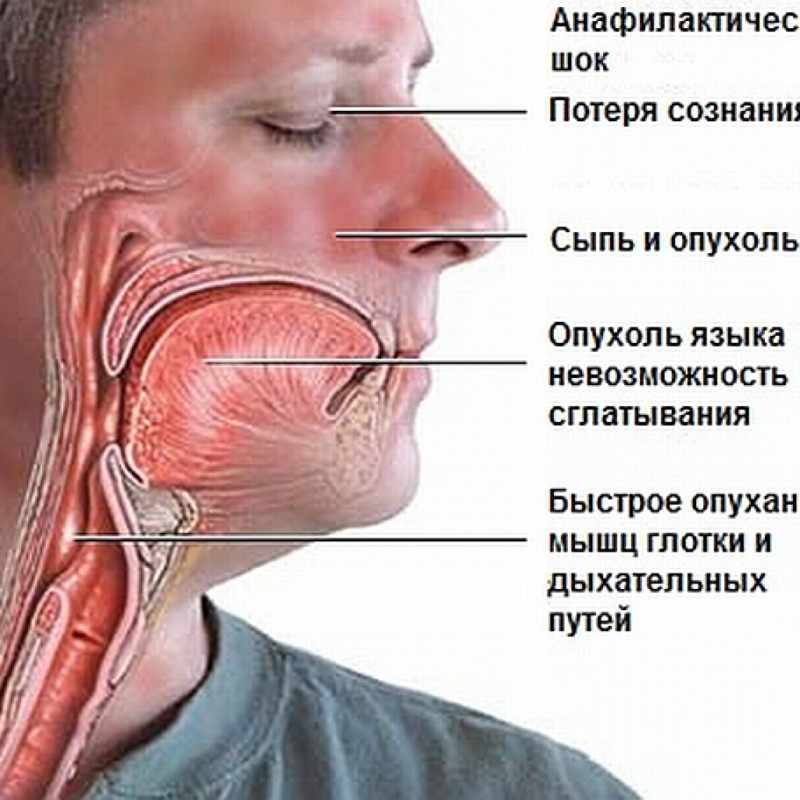 Реакция организма на аллерген