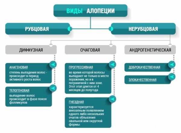 Виды аллопеции