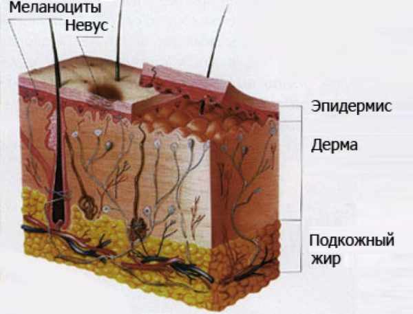 Схема невуса