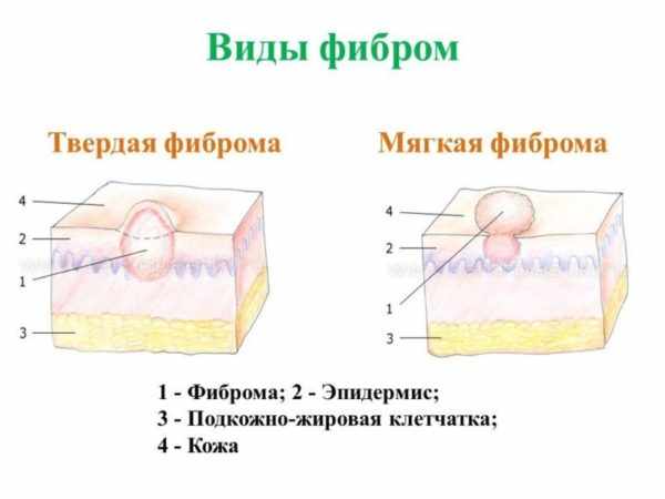 Виды фибром