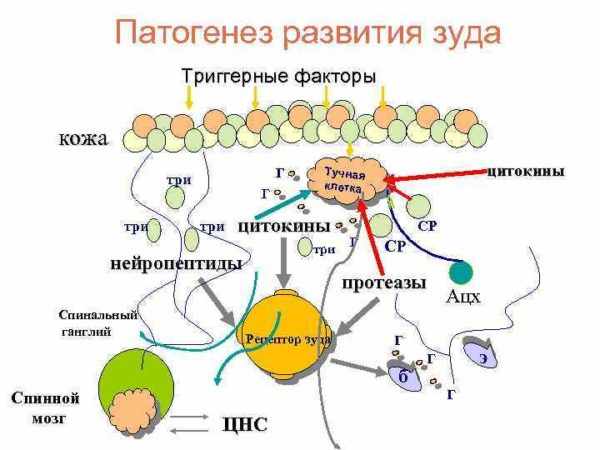 Механизм развития зуда