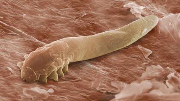 Demodex