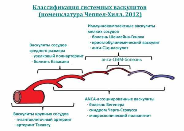 Классификация васкулитов