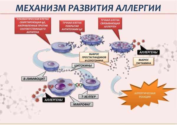 Механизм развития аллергии