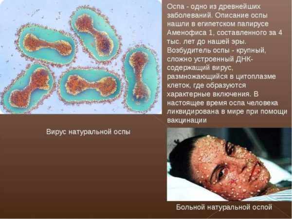 Возбудитель черной (натуральной) оспы