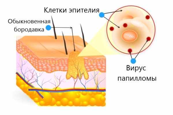 ВПЧ