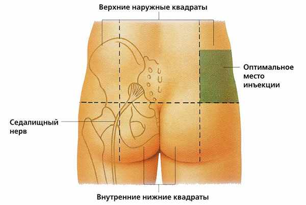 Оптимальная область для в/м инъекции