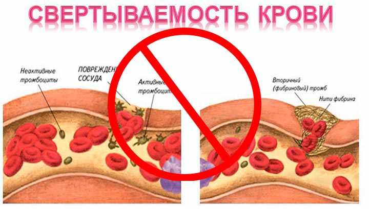 Плохая свертываемость крови