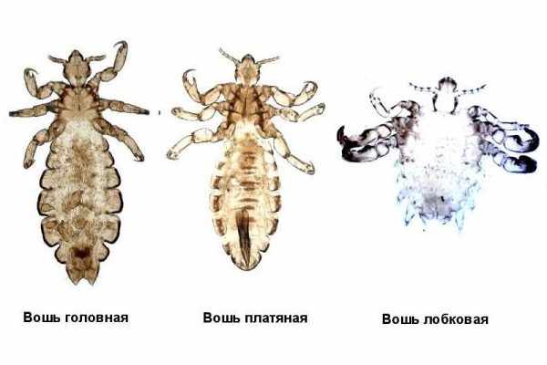 Виды вшей у человека
