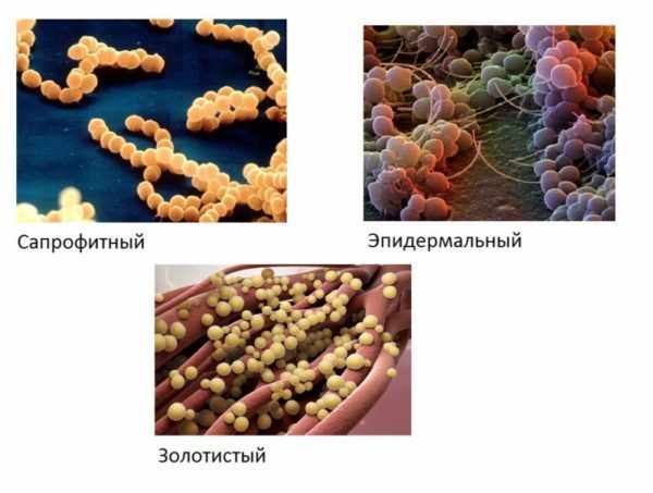 Разновидности стафилококка